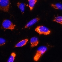 Anti-BNP Antibody