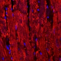 Anti-BNP Antibody