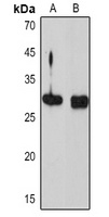 NGF beta Rabbit Polyclonal Antibody