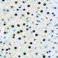 Anti-DNMT3B Antibody