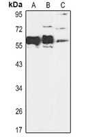 SMAD5 Rabbit Polyclonal Antibody