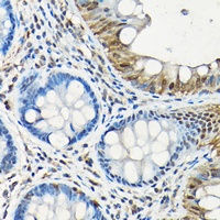 Anti-SMAD5 Antibody