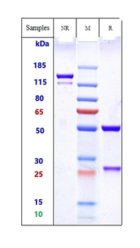 ERBB2/HER2/CD340 Antibody