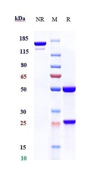 AXL/UFO Antibody