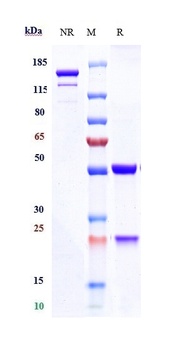 TNFSF7/CD27L/CD70 Antibody