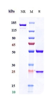 PRLR/Prolactin Receptor Antibody
