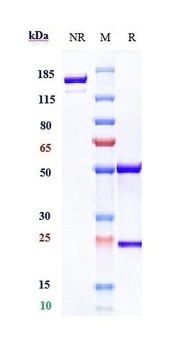 FOLH1/PSMA Antibody