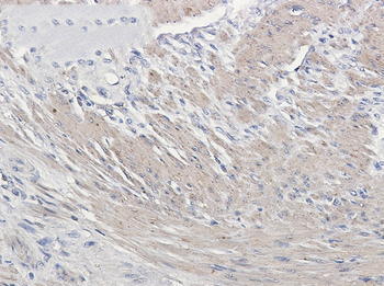 alpha Skeletal Muscle Actin Rabbit mAb Antibody