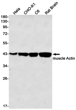alpha Skeletal Muscle Actin Rabbit mAb Antibody