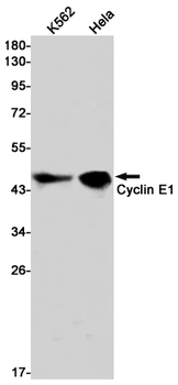 Cyclin E1 Rabbit mAb Antibody