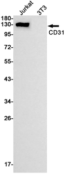 CD31 Rabbit mAb Antibody