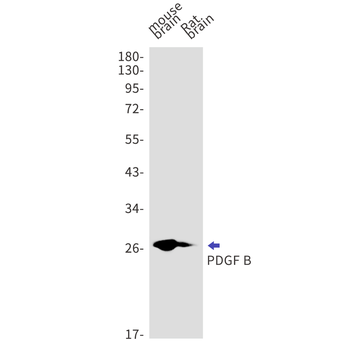 PDGF B Rabbit mAb Antibody