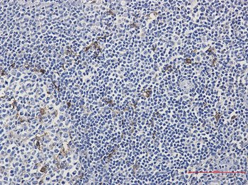 MERTK Rabbit Monoclonal Antibody