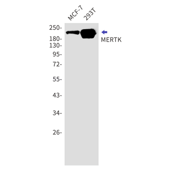 MERTK Rabbit Monoclonal Antibody