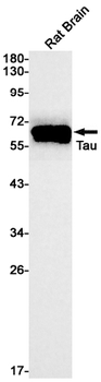 Tau Rabbit mAb Antibody
