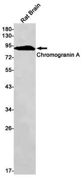Chromogranin A Rabbit mAb Antibody