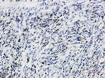 Caspase 3 Rabbit mAb Antibody