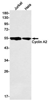 Cyclin A2 Rabbit mAb
