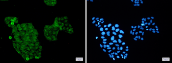 AKT Rabbit mAb Antibody