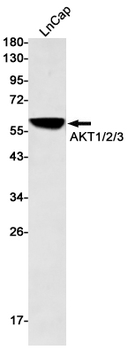AKT Rabbit mAb Antibody