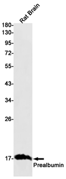 Prealbumin Rabbit mAb Antibody