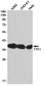 Thyroid Transcription Factor 1 Rabbit mAb Antibody