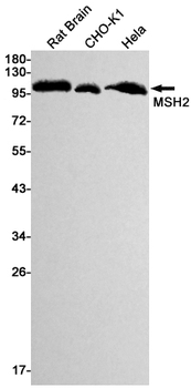 MSH2 Rabbit mAb Antibody