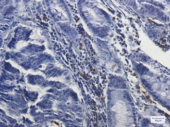 Myeloperoxidase Rabbit Monoclonal Antibody