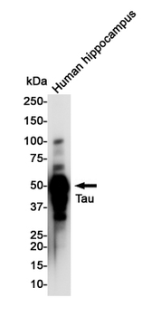 Tau Rabbit mAb Antibody