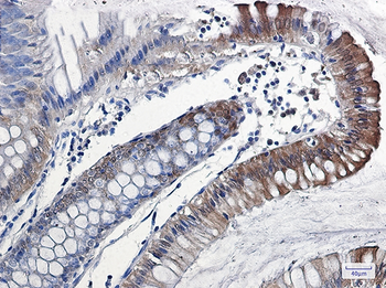 IL 18 Rabbit Monoclonal Antibody
