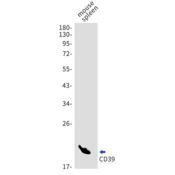 CD39 Rabbit mAb Antibody
