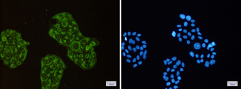 ACADM Rabbit mAb Antibody