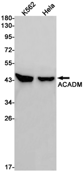 ACADM Rabbit mAb Antibody