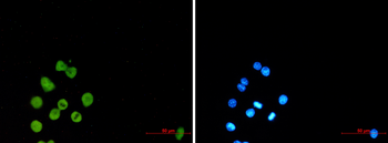 SPI1 Rabbit mAb Antibody