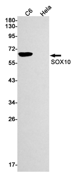 SOX10 Rabbit mAb Antibody