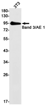 Band 3 Rabbit mAb Antibody