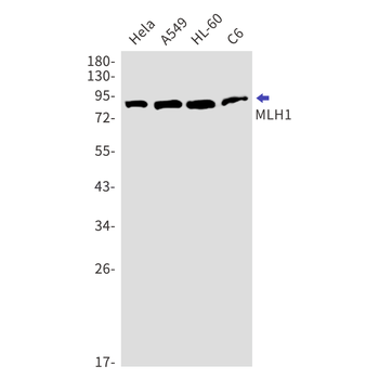 MLH1 Rabbit mAb