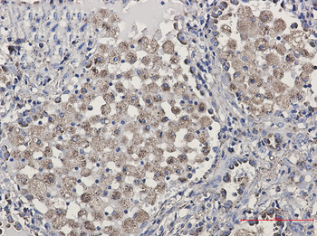 LAMP2 Rabbit mAb Antibody
