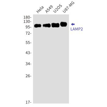 LAMP2 Rabbit mAb Antibody