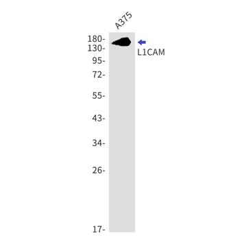 L1CAM Rabbit mAb Antibody