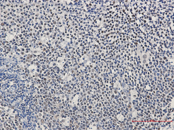 Ikaros Rabbit mAb Antibody