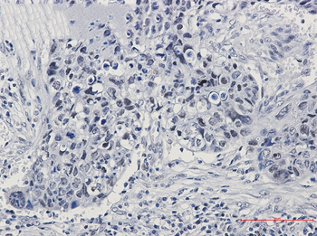 hnRNP K Rabbit mAb Antibody
