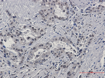 FKBP52 Rabbit mAb Antibody