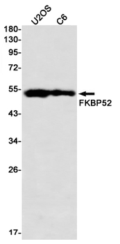 FKBP52 Rabbit mAb Antibody