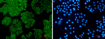 FH Rabbit mAb Antibody
