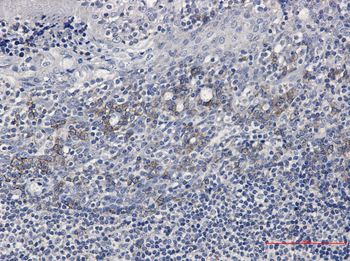 CD32B Rabbit mAb Antibody