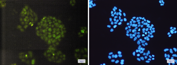 ERCC1 Rabbit Monoclonal Antibody