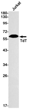 DNA Nucleotidylexotransferase Rabbit mAb Antibody