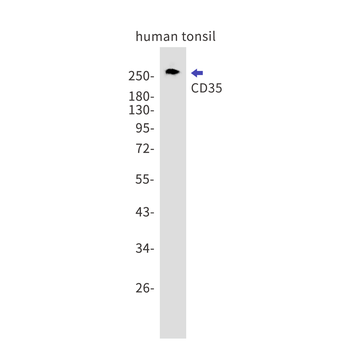 CD35 Rabbit mAb Antibody