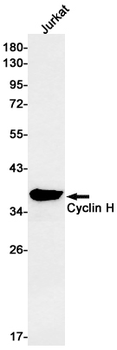 Cyclin H Rabbit mAb Antibody